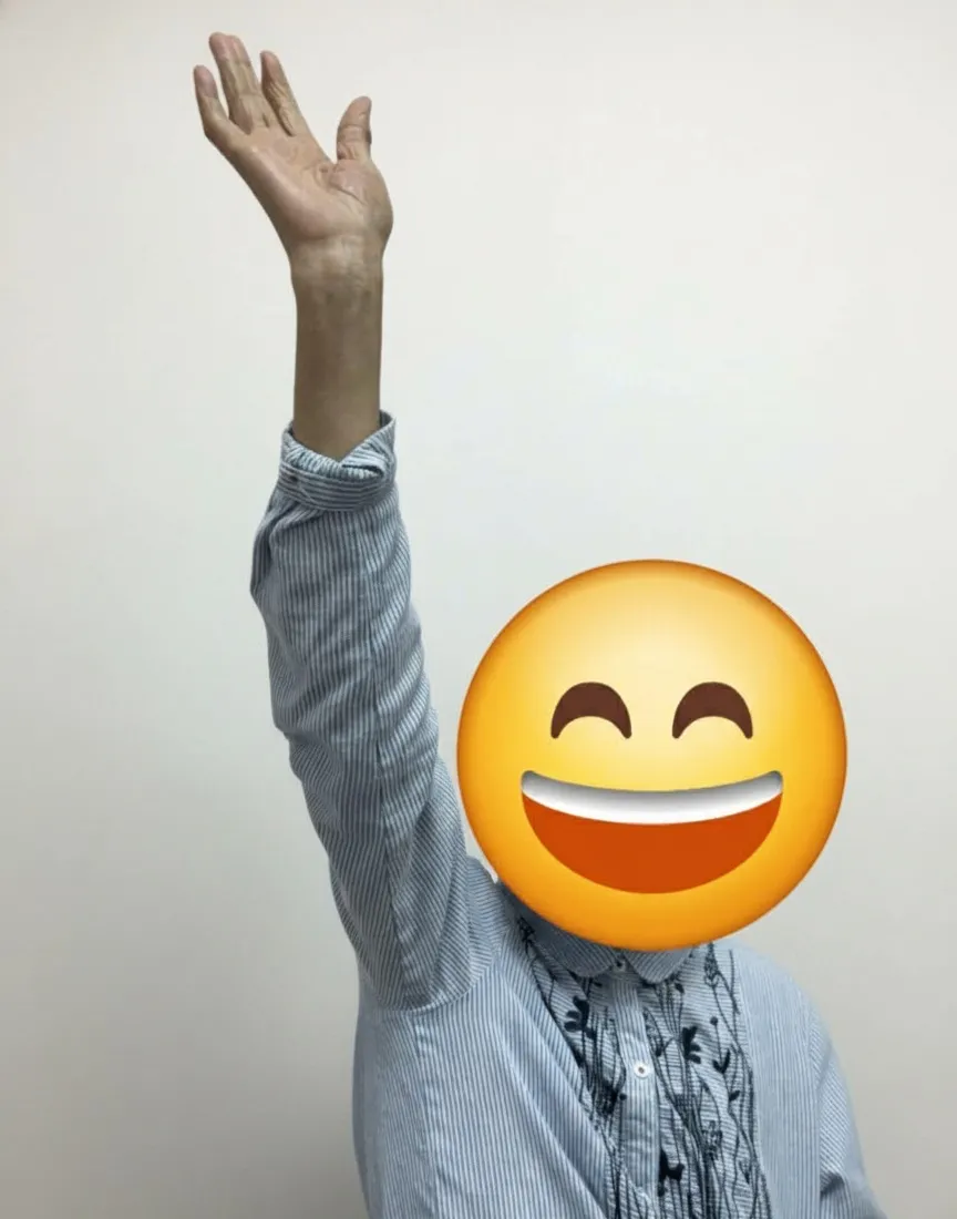 新竹宸新復健科臨床成功案例:50歲的五十肩惡夢:為什麼病人想打 PRP,我卻拒絕了?