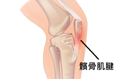 髕骨肌腱結構