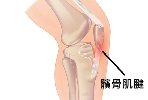 髕骨肌腱結構