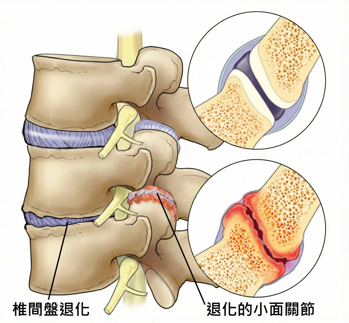 小面關節結構圖
