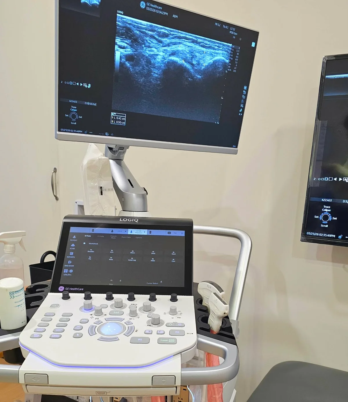  宸新復健科超音波GE LOGIQ Totus 機器照片