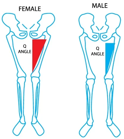 「Q角」（Quadriceps Angle，股四頭肌角）