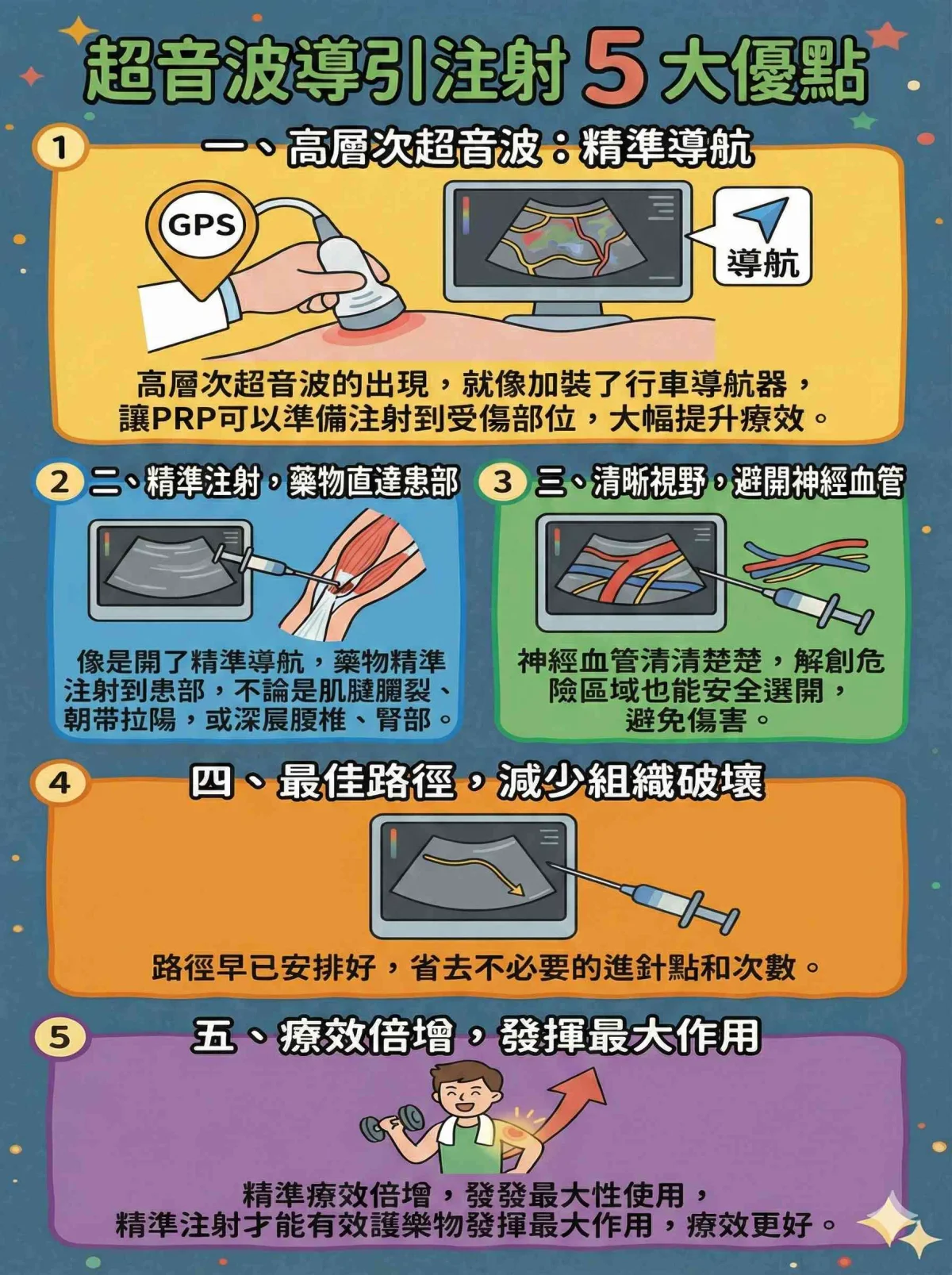 PRP高濃度血小板超音波導引注射示意圖